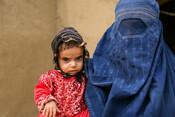 Ara*, 18 months, who is severely malnourished, is held by her mother Fatima*, 21