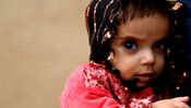 Ara*, 18 months, who is severely malnourished, is held by her mother Fatima*, 21